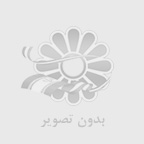 فرق بین کاشت دائم و کاشت موقت مژه